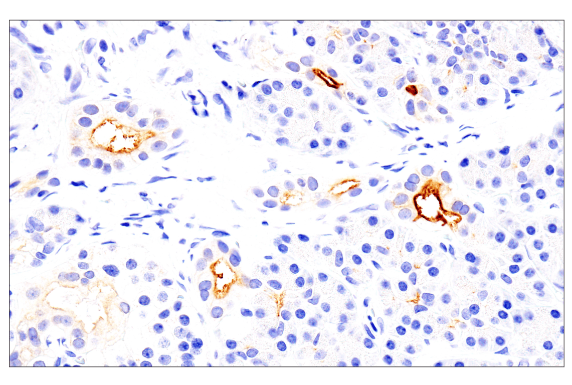 Immunohistochemistry Image 8: Folate Receptor Alpha/FOLR1 (BN3.2) Mouse Monoclonal Antibody