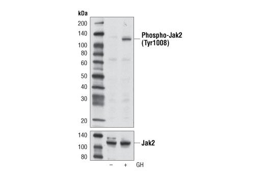 Western Blotting Image 3: Phospho-Jak2 (Tyr1008) (D4A8) Rabbit Monoclonal Antibody