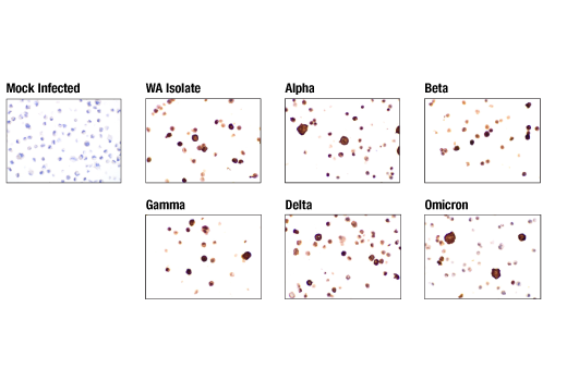 Immunohistochemistry Image 6: SARS-CoV-2 Nucleocapsid Protein (E9L7H) Rabbit Monoclonal Antibody