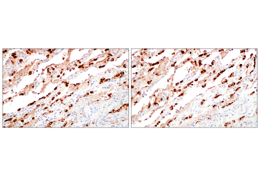 Immunohistochemistry Image 10: LAMP3/CD208 (E6E5U) Rabbit Monoclonal Antibody