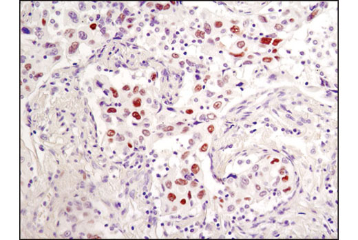 Immunohistochemistry Image 2: Phospho-c-Jun (Ser73) (D47G9) Rabbit Monoclonal Antibody (BSA and Azide Free)