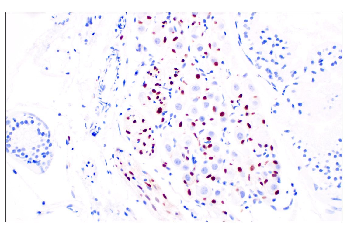 Immunohistochemistry Image 8: Sox10 (E2V9N) Rabbit Monoclonal Antibody (BSA and Azide Free)