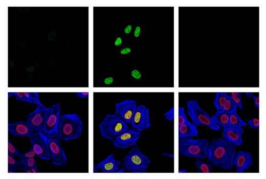 Immunofluorescence Image 1: Phospho-ATF-2 (Thr69/71)/ATF-7 (Thr51/53) (E6A8A) Rabbit Monoclonal Antibody (BSA and Azide Free)