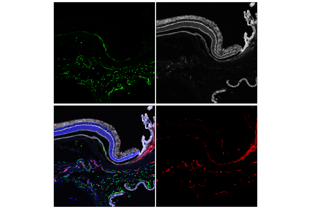 LYVE-1 (E3L3V) Rabbit mAb | Cell Signaling Technology
