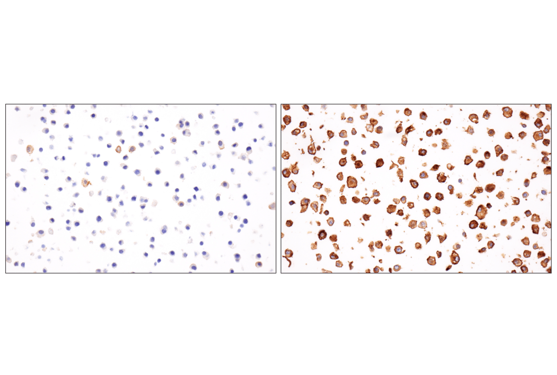 Immunohistochemistry Image 6: PD-L1 (F3Z1T) Rabbit Monoclonal Antibody (BSA and Azide Free)