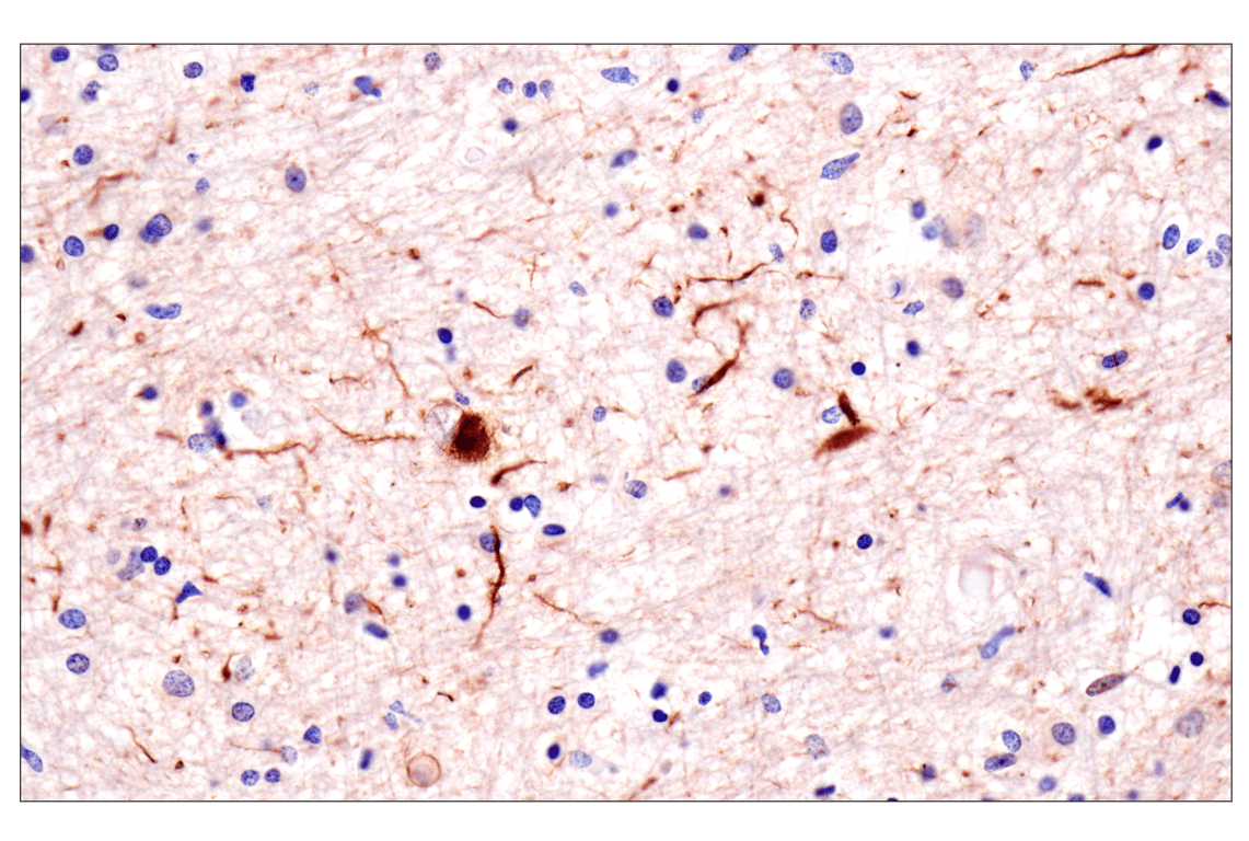 Immunohistochemistry Image 1: Phospho-Tau (Ser396) (F3S9T) Rabbit Monoclonal Antibody