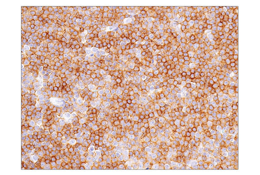 Immunohistochemistry Image 1: CD47 (D3O7P) Rabbit Monoclonal Antibody (BSA and Azide Free)