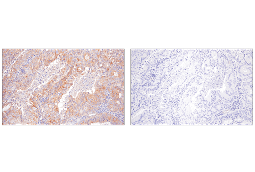 Immunohistochemistry Image 3: Nectin-2/CD112 (D8D3F) Rabbit Monoclonal Antibody (BSA and Azide Free)