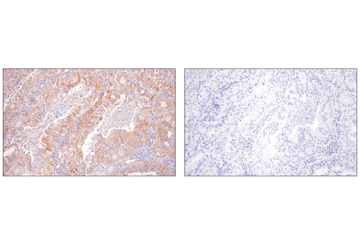 Immunohistochemistry Image 3: Nectin-2/CD112 (D8D3F) XP<sup>®</sup> Rabbit mAb (BSA and Azide Free)