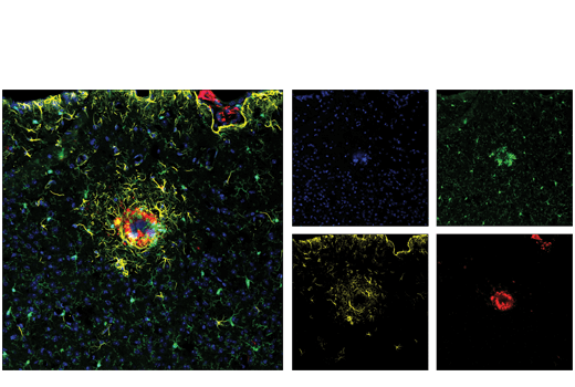 Immunofluorescence Image 1: beta-Amyloid (D54D2) Rabbit Monoclonal Antibody (Alexa Fluor<sup>®</sup> 647 Conjugate)