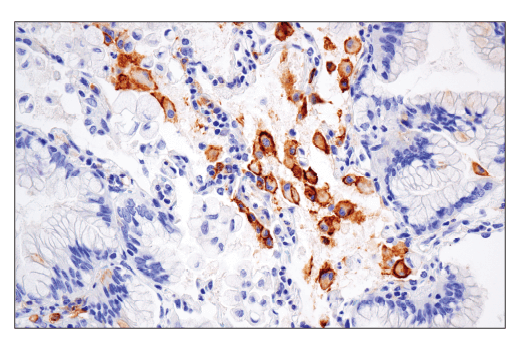 Immunohistochemistry Image 1: CD86 (E2G8P) Rabbit Monoclonal Antibody (BSA and Azide Free)