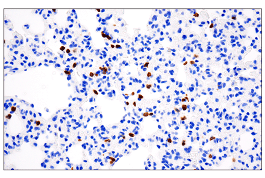 Immunohistochemistry Image 1: CD3 epsilon (E4T1B) Rabbit Monoclonal Antibody