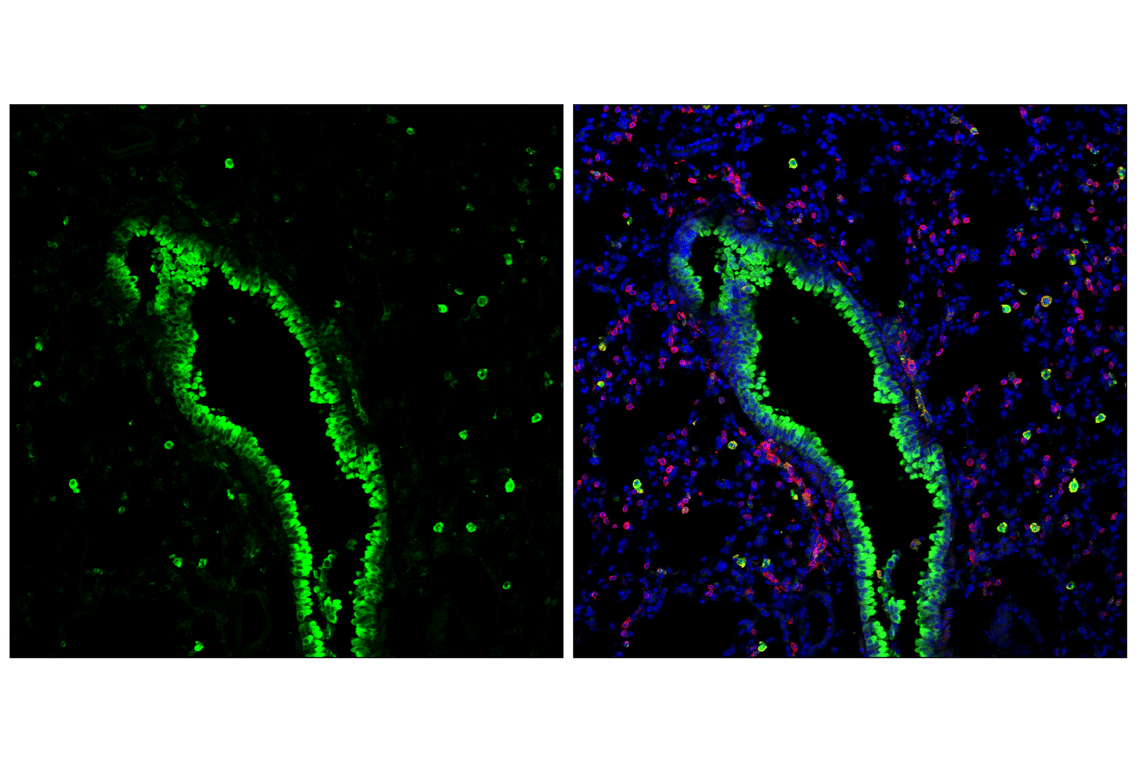Immunofluorescence Image 2: Dectin-1/ Clec7a (E3P5W) Rabbit Monoclonal Antibody (BSA and Azide Free)