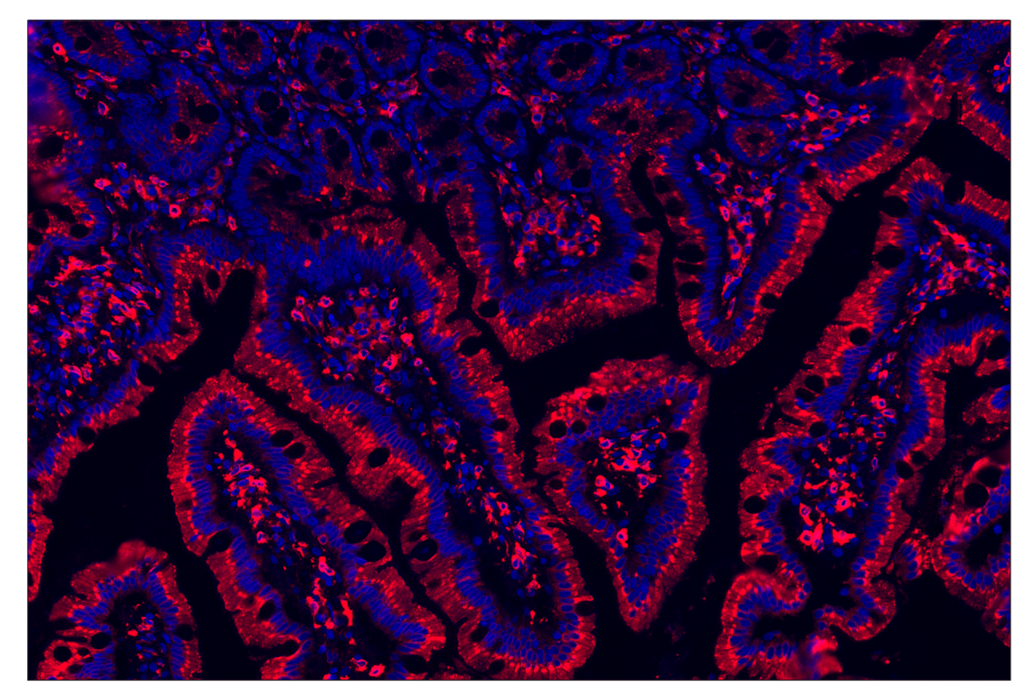 Immunohistochemistry Image 1: CD74 (D5N3I) & CO-0210-488 SignalStar<sup>®</sup> Oligo-Antibody Pair
