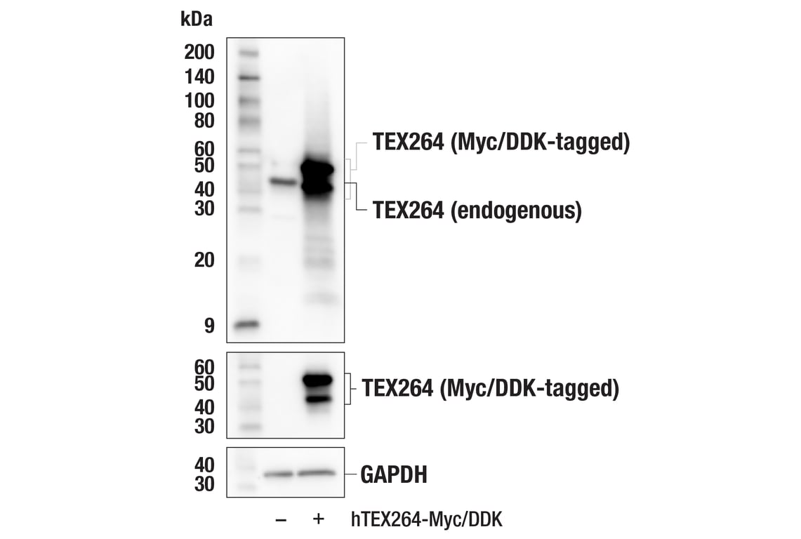 Western Blotting Image 2: TEX264 (E2J3J) Rabbit Monoclonal Antibody