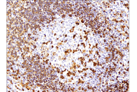 Immunohistochemistry Image 2: SLP-76 (D1R1A) Rabbit Monoclonal Antibody (BSA and Azide Free)