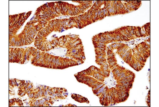 Immunohistochemistry Image 2: SOD2 (D3X8F) Rabbit Monoclonal Antibody (BSA and Azide Free)