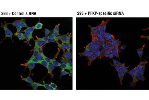 Immunofluorescence Image 1: PFKP (D2E5) Rabbit Monoclonal Antibody