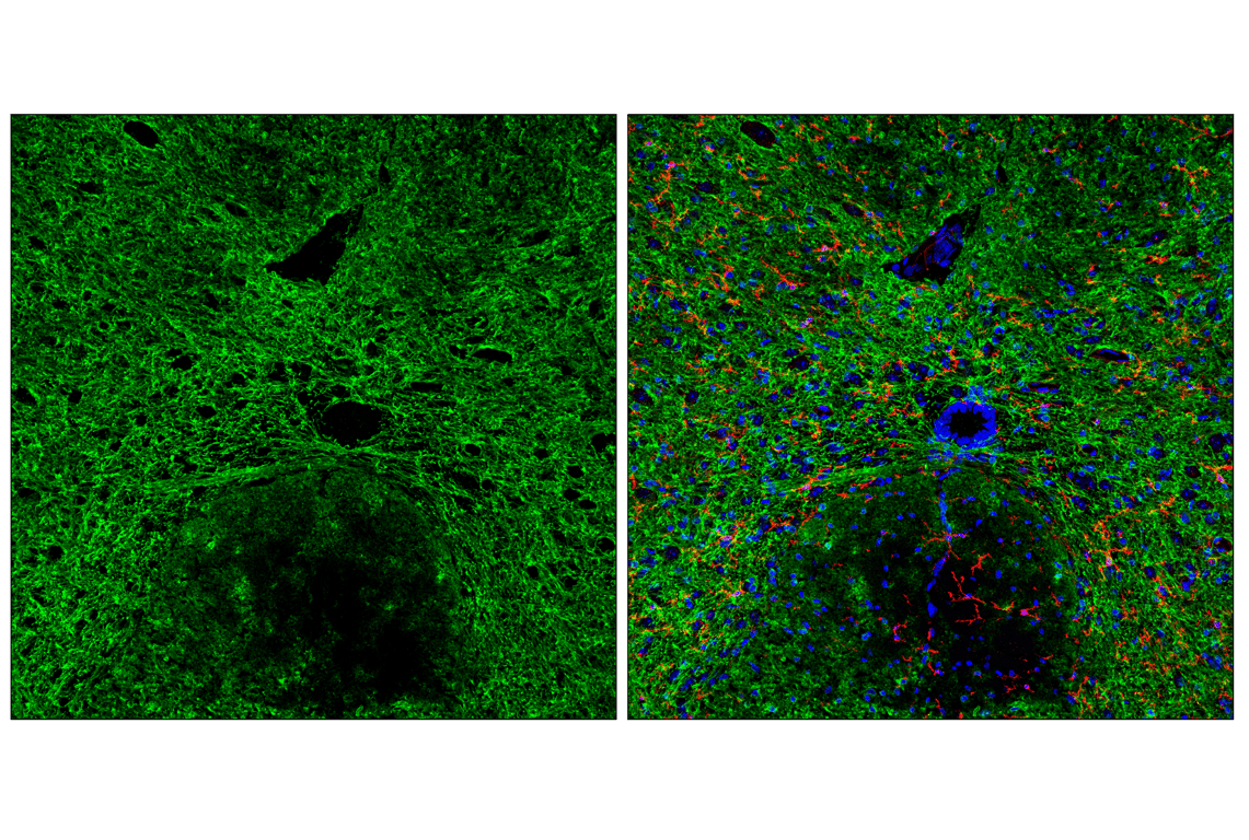 Immunofluorescence Image 1: CNPase (F6Y2X) Mouse Monoclonal Antibody