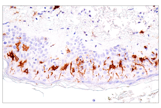 Immunohistochemistry Image 1: CD1A (MTB1) Mouse Monoclonal Antibody