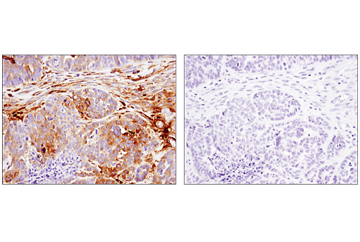 Immunohistochemistry Image 3: IFIT1 (D2X9Z) Rabbit Monoclonal Antibody