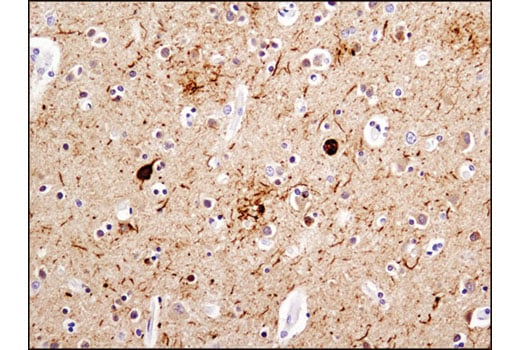 undefined Image 27: Pathological Hallmarks of Alzheimer's Disease Antibody Sampler Kit