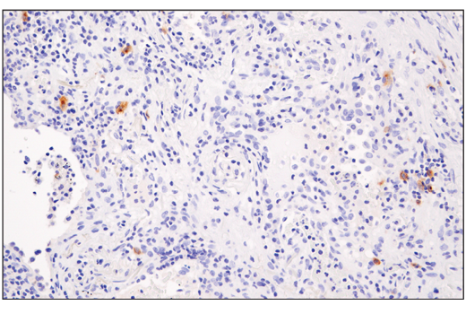 Immunohistochemistry Image 2: XCR1 (D2F8T) Rabbit Monoclonal Antibody