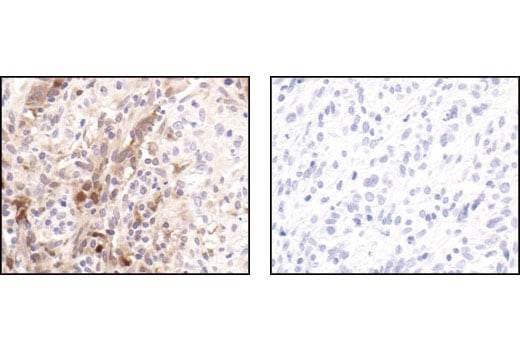 Immunohistochemistry Image 3: Stat1 (42H3) Rabbit Monoclonal Antibody (BSA and Azide Free)