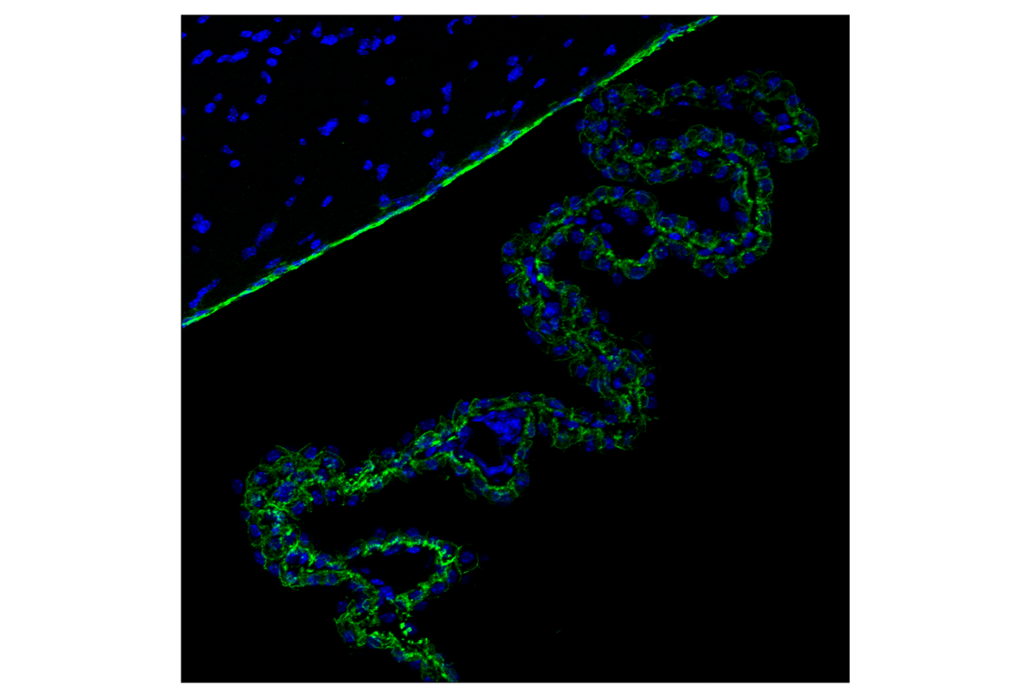 undefined Image 77: Epithelial-Mesenchymal Transition (EMT) Antibody Sampler Kit