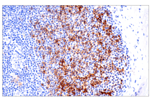 Immunohistochemistry Image 4: CD23 (E1R4G) Rabbit Monoclonal Antibody (BSA and Azide Free)
