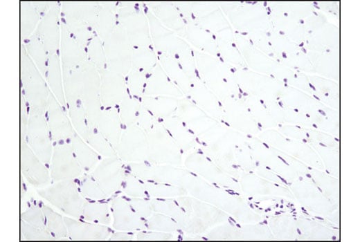 Immunohistochemistry Image 2: Ki-67 (D3B5) Rabbit Monoclonal Antibody (IHC Formulated)