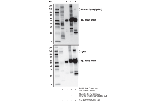 Immunoprecipitation Image 3: Phospho-Axl (Tyr698)/Mer (Tyr749)/Tyro3 (Tyr681) (D6M4W) Rabbit Monoclonal Antibody