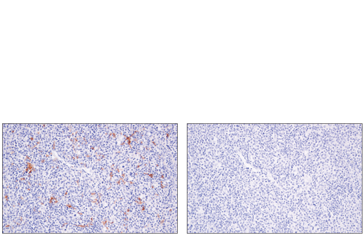 Immunohistochemistry Image 5: XCR1 (D2F8T) Rabbit Monoclonal Antibody