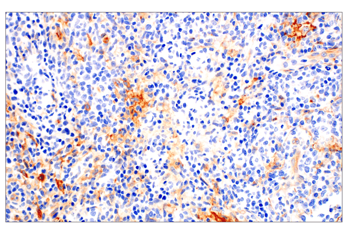 Immunohistochemistry Image 1: IL-13RA2/CD213a2 (E7U7B) Rabbit Monoclonal Antibody