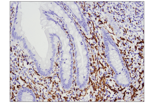 Tau (D1M9X) XP® Rabbit mAb | Cell Signaling Technology