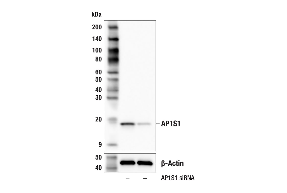 Western Blotting Image 3: AP1S1 (F8K5S) Rabbit Monoclonal Antibody