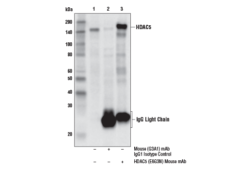 Immunoprecipitation Image 1: HDAC5 (E6G3N) Mouse Monoclonal Antibody