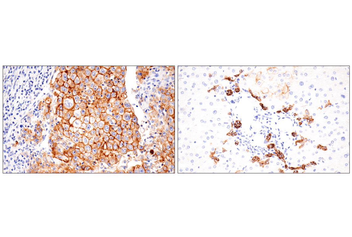 Immunohistochemistry Image 4: EpCAM (D9S3P) Rabbit Monoclonal Antibody