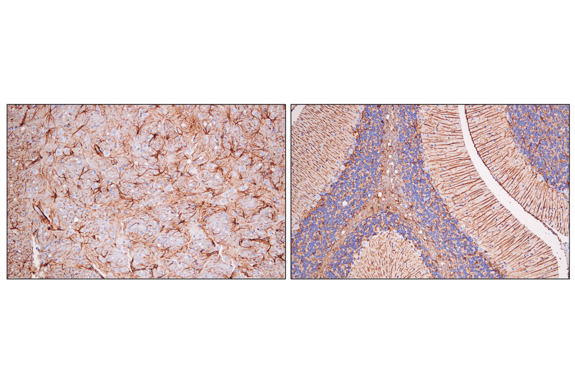 Immunohistochemistry Image 6: GFAP (E4L7M) XP<sup>®</sup> Rabbit mAb (BSA and Azide Free)