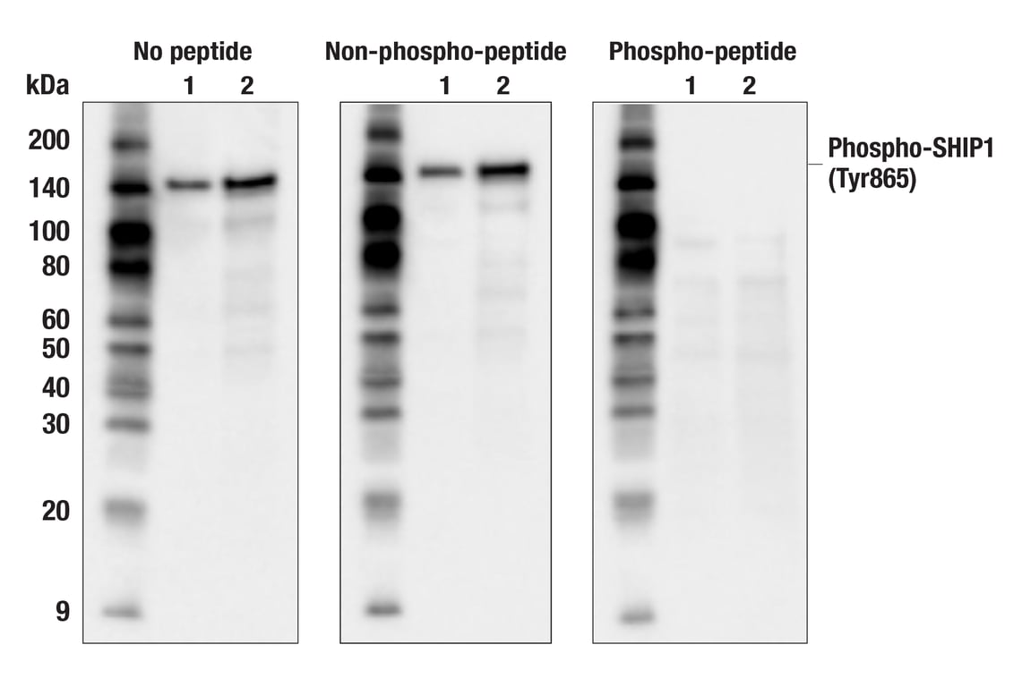 Western Blotting Image 3: Phospho-SHIP1 (Tyr865) (F3N9M) Rabbit Monoclonal Antibody