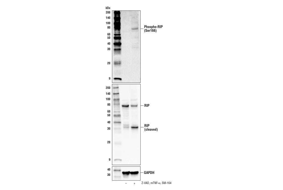Western Blotting Image 3: Phospho-RIP (Ser166) (E7G6O) Rabbit Monoclonal Antibody