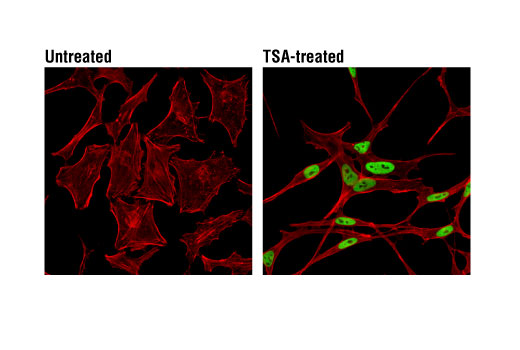 Immunofluorescence Image 1: Acetyl-Histone H3 (Lys14) (D4B9) Rabbit Monoclonal Antibody