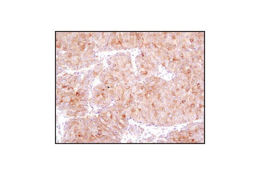 Immunohistochemistry Image 1: Fatty Acid Synthase (C20G5) Rabbit Monoclonal Antibody