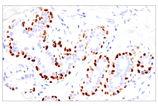 Immunohistochemistry Image 2: p40 (BC28) Mouse Monoclonal Antibody