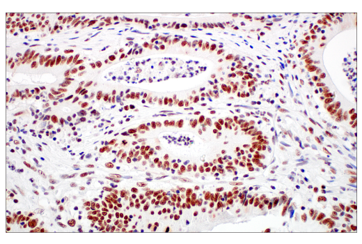 AABBCC様 Amazon.com: Ford Genuine Engine Crank Case Emission Tube