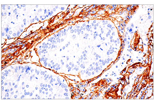 Immunohistochemistry Image 3: COL1A1 (E3E1X) Mouse Monoclonal Antibody (BSA and Azide Free)