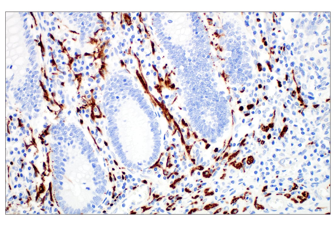 Immunohistochemistry Image 4: beta3-Tubulin (E9F3E) Mouse Monoclonal Antibody (BSA and Azide Free)
