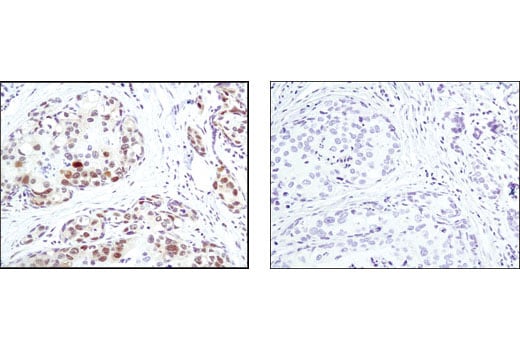Immunohistochemistry Image 1: Phospho-MAPK/CDK Substrates (PXS*P or S*PXR/K) (34B2) Rabbit Monoclonal Antibody