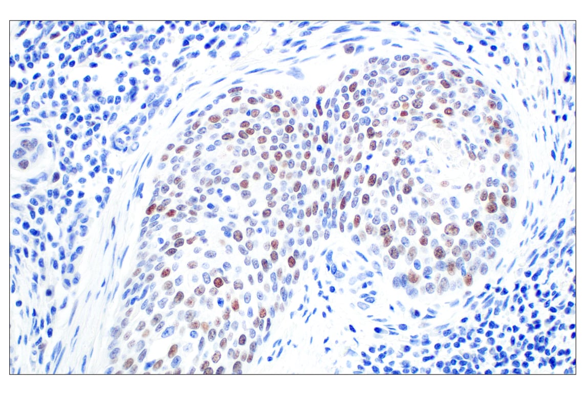 Immunohistochemistry Image 2: BRCA1 (E5S9G) Rabbit Monoclonal Antibody (BSA and Azide Free)