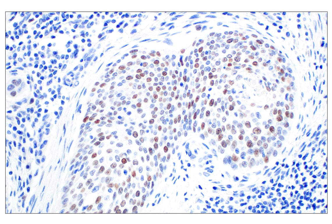 Immunohistochemistry Image 2: BRCA1 (E5S9G) Rabbit mAb (BSA and Azide Free)